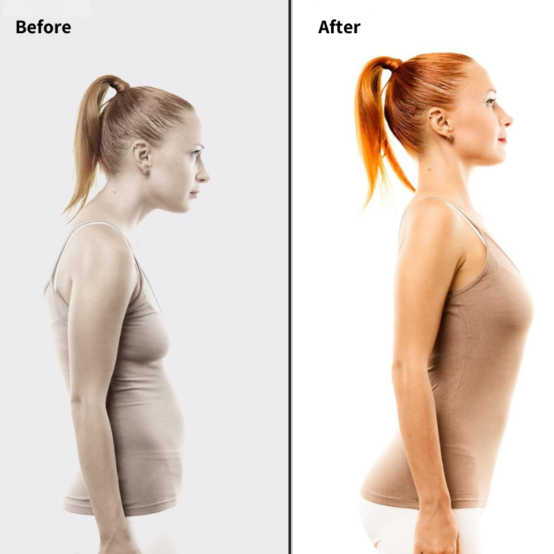 OCW Back Posture Corrector Adjustable Support Straps Anti-hunchback Brace