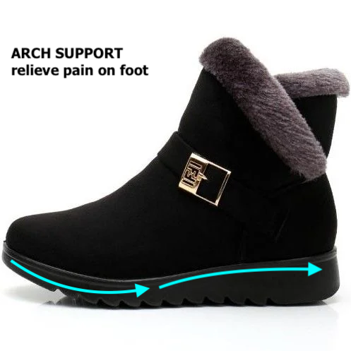 OCW Orthopedic Women Ankle Boots Fur Lined Super Warm Winter Comfortable Shoes OCWShoes