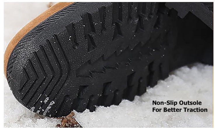 OCW Snow Orthopedic Boots For Women Arch Support Warm Fur Plush Insole Keep Warm Winter OCWShoes