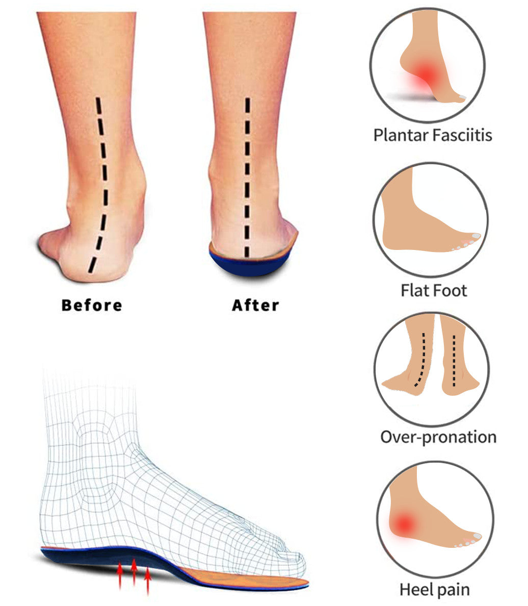 GEIASOU Orthopedic Insoles Foot Pain Relief Memory Foam Arch Support Soft Insoles OCWShoes