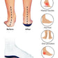GEIASOU Orthopedic Insoles Memory Foam Breathable Feet Care Support